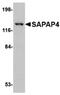 PSD-95/SAP90-binding protein 4 antibody, PA5-20558, Invitrogen Antibodies, Western Blot image 