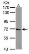 Calcium Voltage-Gated Channel Auxiliary Subunit Beta 4 antibody, GTX100202, GeneTex, Western Blot image 