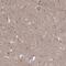 Rho GTPase Activating Protein 20 antibody, NBP1-81411, Novus Biologicals, Immunohistochemistry paraffin image 