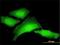 Poly(RC) Binding Protein 1 antibody, H00005093-M01, Novus Biologicals, Immunocytochemistry image 