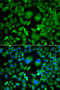 Ubiquitin Conjugating Enzyme E2 H antibody, STJ29483, St John