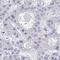 PR/SET Domain 9 antibody, HPA059555, Atlas Antibodies, Immunohistochemistry paraffin image 