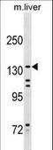 Kinesin Family Member 15 antibody, LS-C159996, Lifespan Biosciences, Western Blot image 