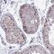 Zinc Finger And BTB Domain Containing 25 antibody, NBP2-31583, Novus Biologicals, Immunohistochemistry frozen image 