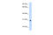 ST3 Beta-Galactoside Alpha-2,3-Sialyltransferase 3 antibody, 30-220, ProSci, Enzyme Linked Immunosorbent Assay image 