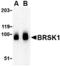 BR Serine/Threonine Kinase 1 antibody, A05997-1, Boster Biological Technology, Western Blot image 