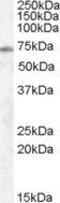 Exocyst Complex Component 7 antibody, PA5-18508, Invitrogen Antibodies, Western Blot image 