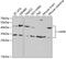 VAMP Associated Protein B And C antibody, GTX32958, GeneTex, Western Blot image 