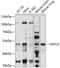 UEV And Lactate/Malate Dehyrogenase Domains antibody, 15-784, ProSci, Western Blot image 