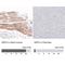 Sirtuin 5 antibody, NBP1-86013, Novus Biologicals, Immunohistochemistry paraffin image 
