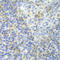 Zeta Chain Of T Cell Receptor Associated Protein Kinase 70 antibody, LS-C331979, Lifespan Biosciences, Immunohistochemistry frozen image 