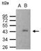 SET And MYND Domain Containing 3 antibody, NBP2-20430, Novus Biologicals, Immunoprecipitation image 