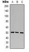 Beta-1,4-Galactosyltransferase 1 antibody, LS-C368884, Lifespan Biosciences, Western Blot image 