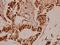 Actin Like 6A antibody, A05553, Boster Biological Technology, Immunohistochemistry frozen image 