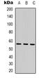 Sestrin 1 antibody, LS-C368926, Lifespan Biosciences, Western Blot image 