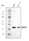 Microtubule Associated Protein 1 Light Chain 3 Alpha antibody, A01543-2, Boster Biological Technology, Western Blot image 