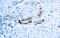 Mesothelin antibody, NBP2-75255, Novus Biologicals, Immunohistochemistry frozen image 