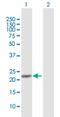 Nicotinamide Riboside Kinase 1 antibody, H00054981-D01P, Novus Biologicals, Western Blot image 