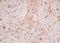 Erb-B2 Receptor Tyrosine Kinase 4 antibody, orb157500, Biorbyt, Immunohistochemistry paraffin image 