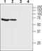 Bestrophin 1 antibody, TA328716, Origene, Western Blot image 