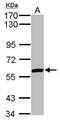 Zinc Finger Protein 345 antibody, PA5-30554, Invitrogen Antibodies, Western Blot image 