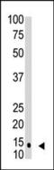 Small Ubiquitin Like Modifier 1 antibody, MA5-11146, Invitrogen Antibodies, Western Blot image 