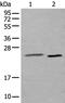 Ubiquitin Conjugating Enzyme E2 T antibody, PA5-67606, Invitrogen Antibodies, Western Blot image 