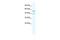 Potassium Two Pore Domain Channel Subfamily K Member 10 antibody, GTX47639, GeneTex, Western Blot image 