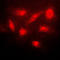 NFKB Inhibitor Beta antibody, GTX32225, GeneTex, Immunocytochemistry image 