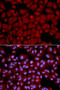 Protein Phosphatase 1 Catalytic Subunit Beta antibody, 13-846, ProSci, Immunofluorescence image 