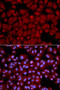 Serine/threonine-protein phosphatase PP1-beta catalytic subunit antibody, 13-846, ProSci, Immunofluorescence image 