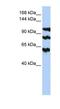 Protein Phosphatase 1 Regulatory Subunit 13B antibody, NBP1-59093, Novus Biologicals, Western Blot image 