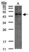 Trimethyllysine Hydroxylase, Epsilon antibody, GTX102856, GeneTex, Western Blot image 