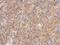 Integral Membrane Protein 2B antibody, NBP2-17000, Novus Biologicals, Immunohistochemistry paraffin image 