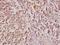 Collagen Type XI Alpha 1 Chain antibody, A02909-1, Boster Biological Technology, Immunohistochemistry frozen image 