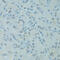 GTF2H2 Family Member C, Copy 2 antibody, 19-548, ProSci, Immunohistochemistry paraffin image 