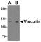 Vinculin antibody, LS-B10133, Lifespan Biosciences, Western Blot image 