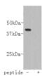 Ceramide Synthase 2 antibody, MBS850687, MyBioSource, Western Blot image 