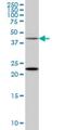 Synaptotagmin 2 antibody, H00127833-M01, Novus Biologicals, Western Blot image 