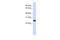 Interleukin 33 antibody, ARP51170_P050, Aviva Systems Biology, Western Blot image 