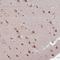 LIM Homeobox 5 antibody, HPA053908, Atlas Antibodies, Immunohistochemistry frozen image 