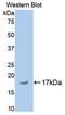 Cartilage Oligomeric Matrix Protein antibody, LS-C293189, Lifespan Biosciences, Western Blot image 