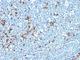 Immunoglobulin Kappa Variable 1D-16 antibody, NBP2-45085, Novus Biologicals, Immunohistochemistry frozen image 