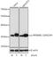 Ribosomal Protein S6 antibody, AP0537, ABclonal Technology, Western Blot image 