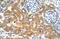 Transmembrane Protein 69 antibody, GTX46338, GeneTex, Immunohistochemistry paraffin image 