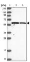 Sterile Alpha Motif Domain Containing 3 antibody, PA5-56030, Invitrogen Antibodies, Western Blot image 