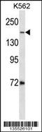 DNA Topoisomerase II Alpha antibody, 58-309, ProSci, Western Blot image 
