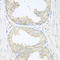 Sarcoglycan Beta antibody, LS-C349004, Lifespan Biosciences, Immunohistochemistry frozen image 
