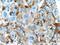 Acyl-CoA Synthetase Medium Chain Family Member 5 antibody, 16591-1-AP, Proteintech Group, Immunohistochemistry frozen image 