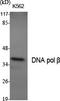 DNA Polymerase Beta antibody, A01946-1, Boster Biological Technology, Western Blot image 